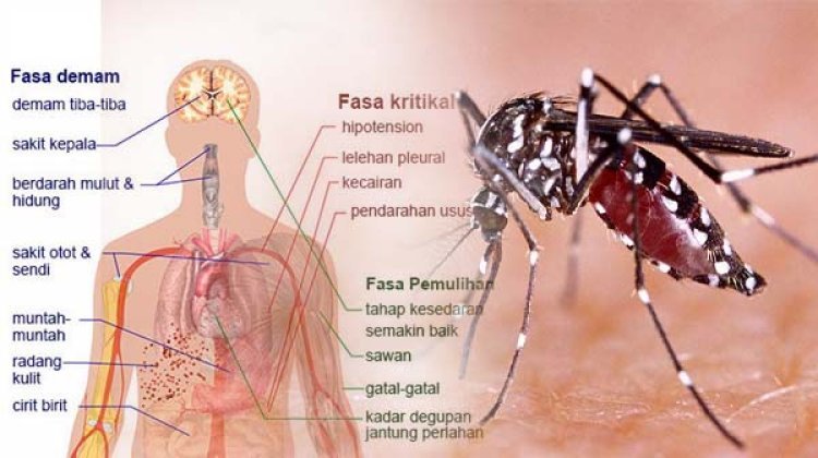 Dengue can be fatal in kids and aged
